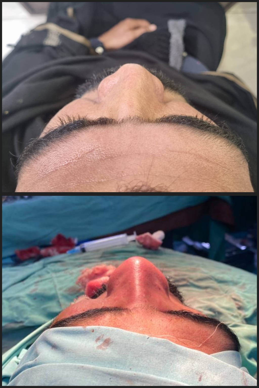 Before & After 2
